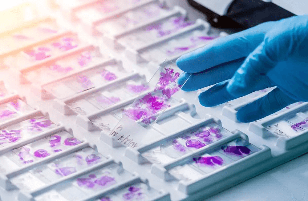 Histopathology